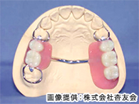 レジン床義歯